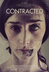 Contracted - Fase I